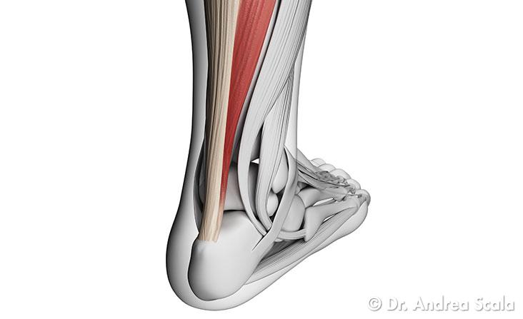 Trapianto del Tendine d’achille