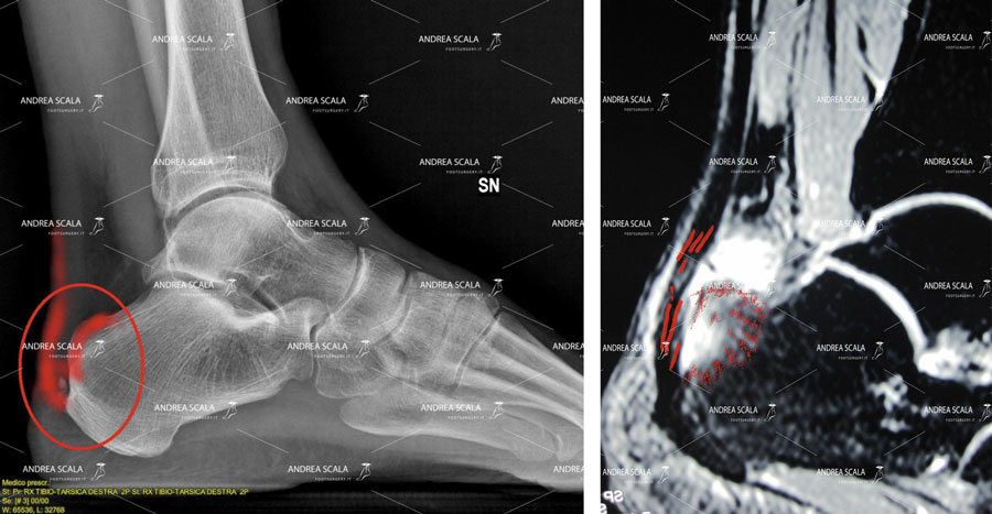 radiografia e risonanza magnetica de Dott. Scala