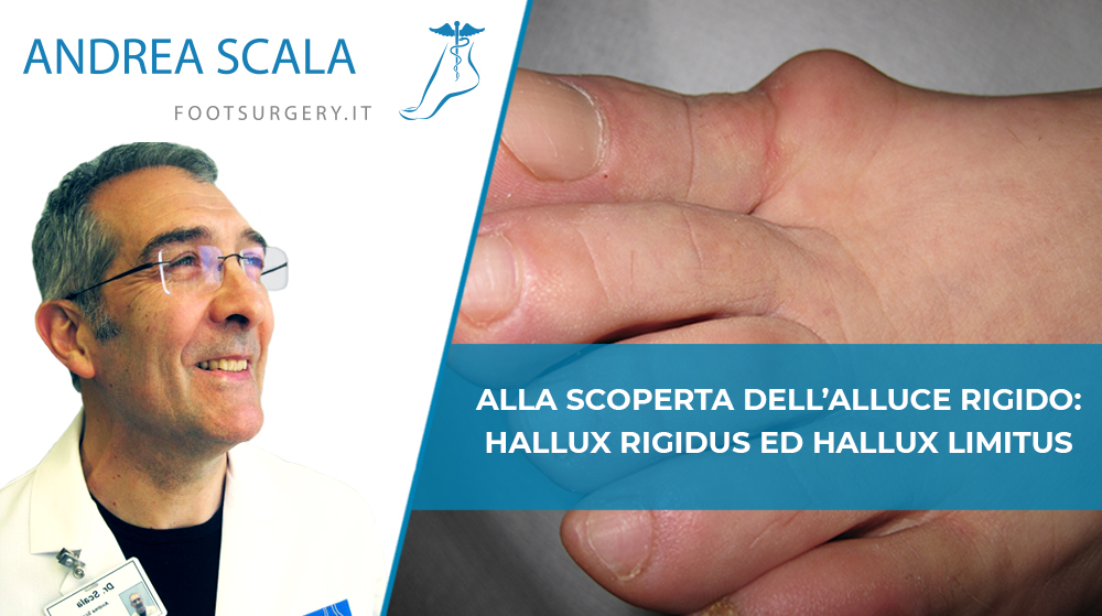 Alla scoperta dell’alluce rigido: Hallux rigidus ed hallux limitus