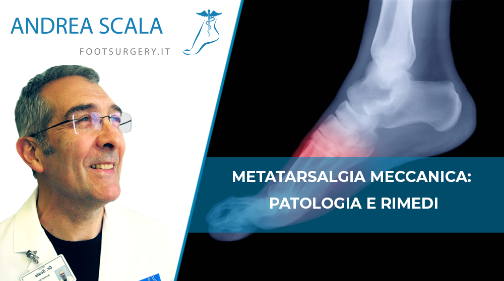 Metatarsalgia Meccanica: patologia e rimedi