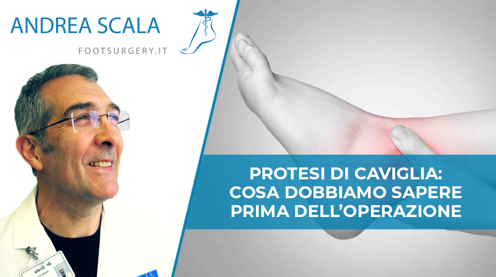 Protesi di caviglia: cosa dobbiamo sapere prima dell’operazione