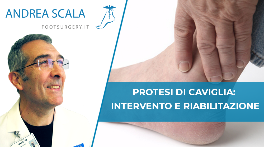 Protesi di Caviglia: intervento e riabilitazione