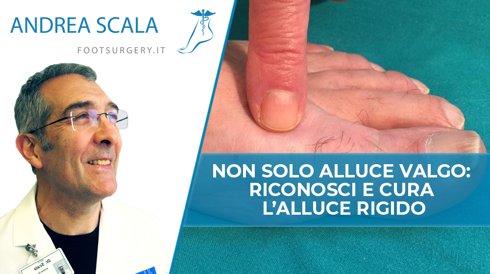 Non solo Alluce Valgo: riconosci e cura l’Alluce Rigido