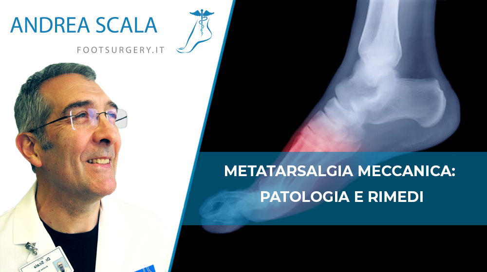 Metatarsalgia Meccanica