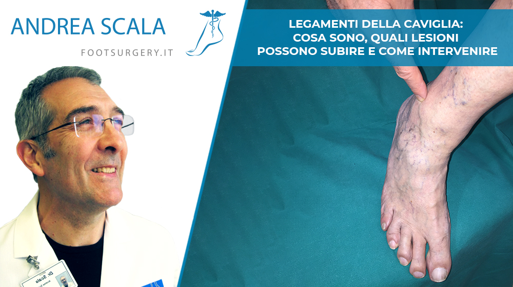 Legamenti della Caviglia: cosa sono, quali lesioni possono subire e come intervenire