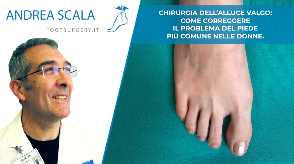 Chirurgia dell’Alluce Valgo: come correggere il problema del piede più comune nelle donne.