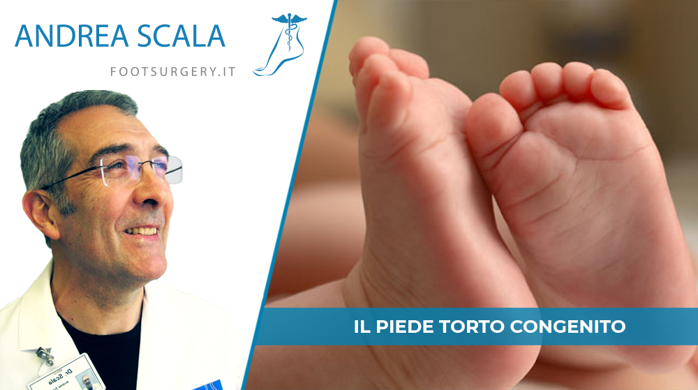 Il piede torto congenito: cause, diagnosi e trattamento.