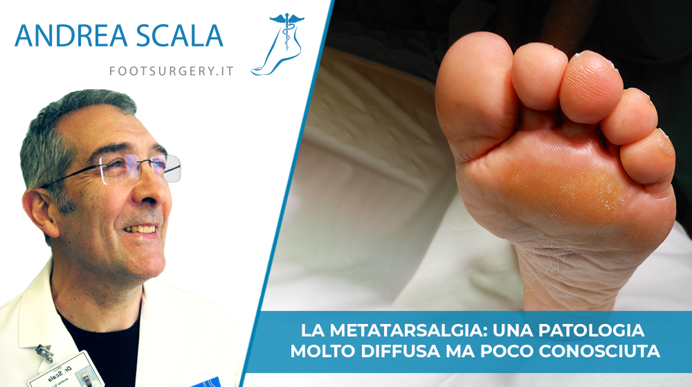 Metatarsalgia: una patologia molto diffusa ma poco conosciuta