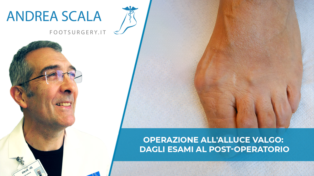 Operazione all’alluce valgo: dagli esami al post-operatorio