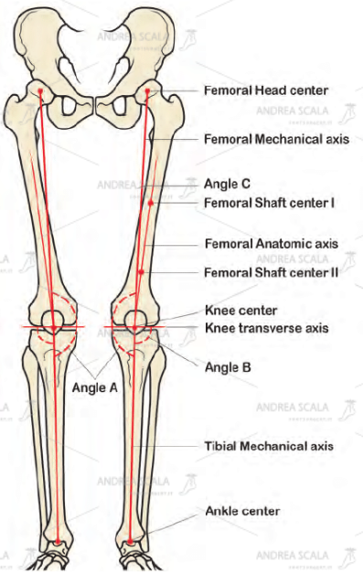 Lo schema mostra quali sono gli assi anatomici e gli assi biomeccanici degli arti inferiori e come si misurano.