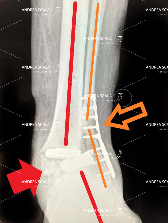 Radiografia