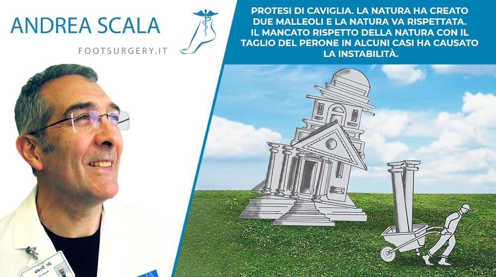 PROTESI DI CAVIGLIA. LA NATURA HA CREATO DUE MALLEOLI E LA NATURA VA RISPETTATA. IL MANCATO RISPETTO DELLA NATURA CON IL TAGLIO DEL PERONE IN ALCUNI CASI HA CAUSATO LA INSTABILITÀ.
