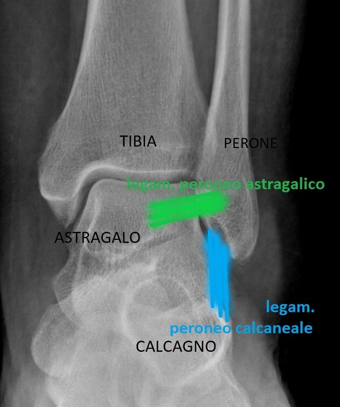 Anatomia Caviglia Normale