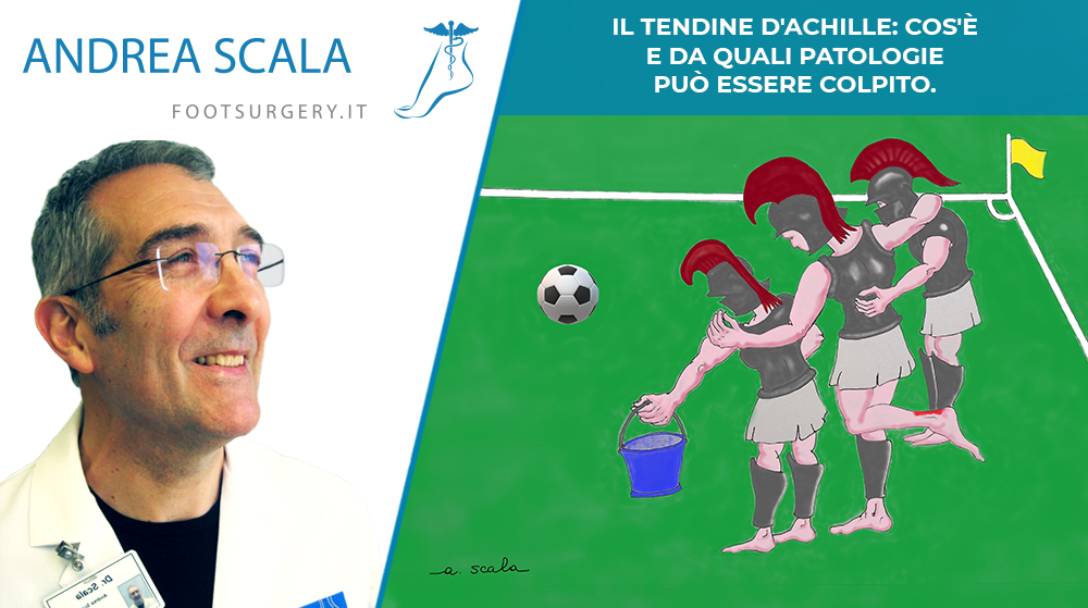 Il tendine d’Achille: cos’è e da quali patologie può essere colpito.