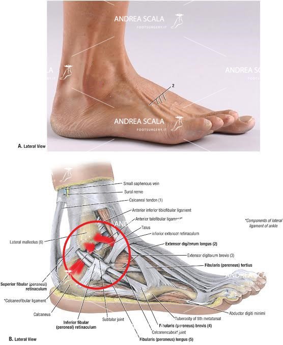 schema legamenti caviglia