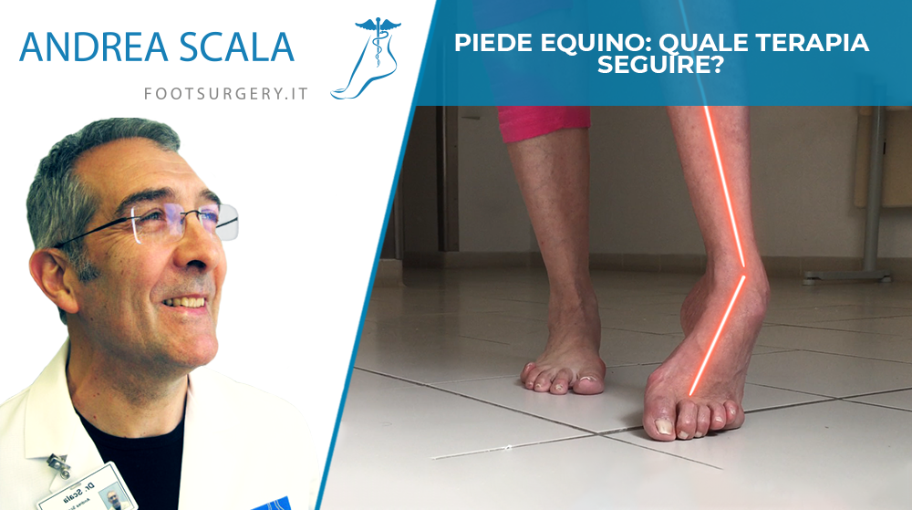 Piede equino: quale terapia seguire?