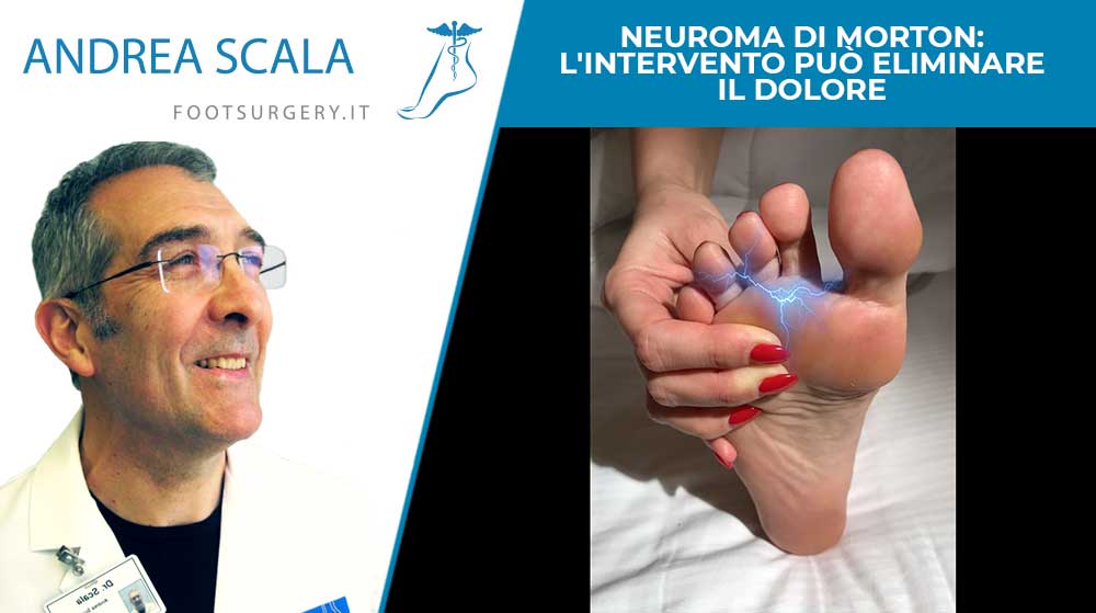 Neuroma di Morton: l’intervento può eliminare il dolore