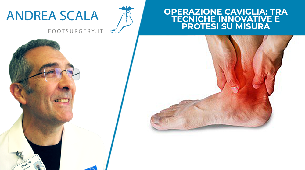 operazione caviglia