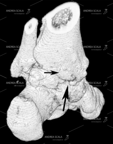 8 Questa ricostruzione 3D della parte postero mediale del piede  è molto ben eseguita e molto ben dettagliata