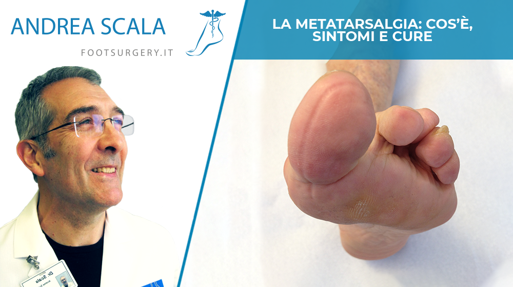 La metatarsalgia: cos’è, sintomi e cure