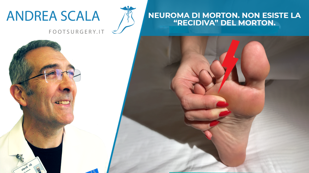 NEUROMA DI MORTON. NON ESISTE LA “RECIDIVA” DEL MORTON.