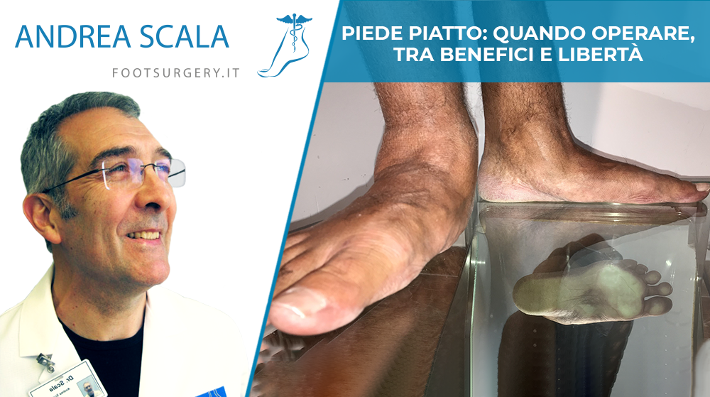 Piede piatto: quando operare, tra benefici e libertà