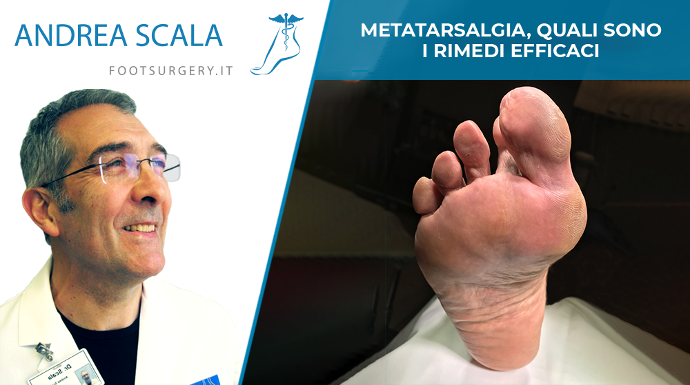 metatarsalgia-dott-andrea-scala