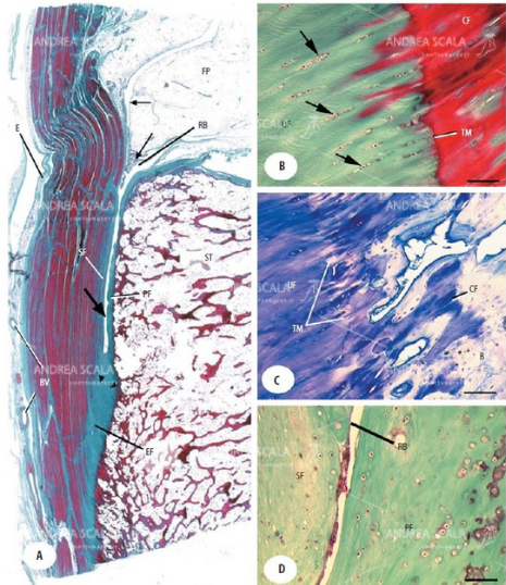 La figura mostra la Anatomia microscopica della inserzione (entesi) del tendine d'Achille al microscopio.