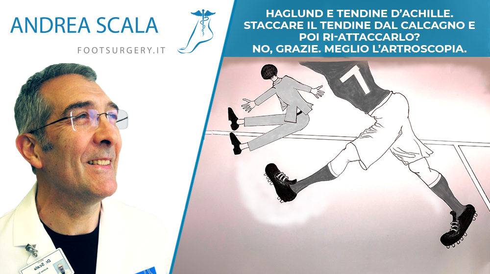 HAGLUND E TENDINE D’ACHILLE. STACCARE IL TENDINE DAL CALCAGNO E POI RI-ATTACCARLO? NO, GRAZIE. MEGLIO L’ARTROSCOPIA.