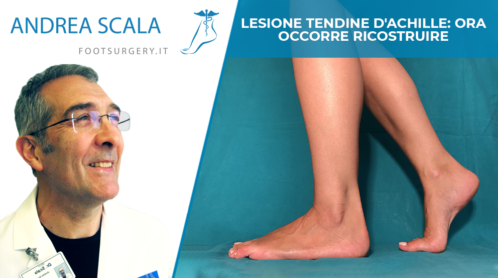 Lesione tendine d’Achille: ora occorre ricostruire