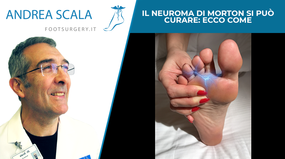 Il Neuroma di Morton si può curare: ecco come