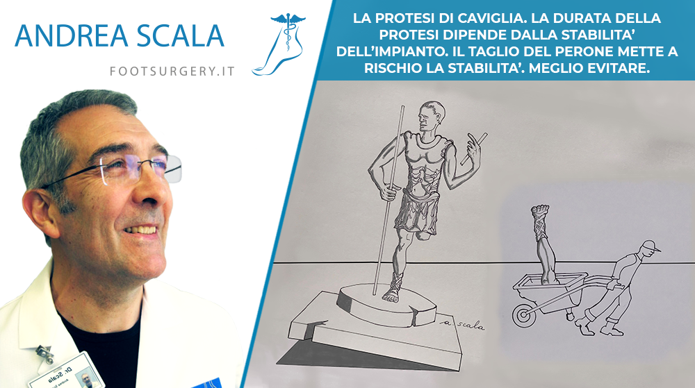 LA PROTESI DI CAVIGLIA. LA DURATA DELLA PROTESI DIPENDE DALLA STABILITA’ DELL’IMPIANTO. IL TAGLIO DEL PERONE METTE A RISCHIO LA STABILITA’. MEGLIO EVITARE.