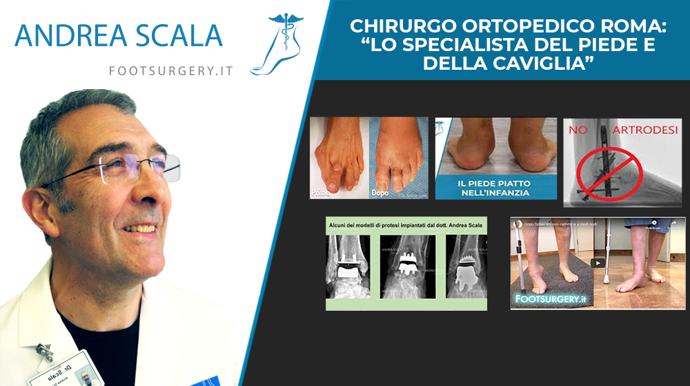 Chirurgo ortopedico Roma: “Lo specialista del piede e della caviglia”