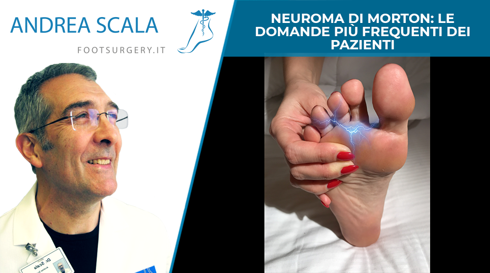 Neuroma di Morton: le domande più frequenti dei pazienti