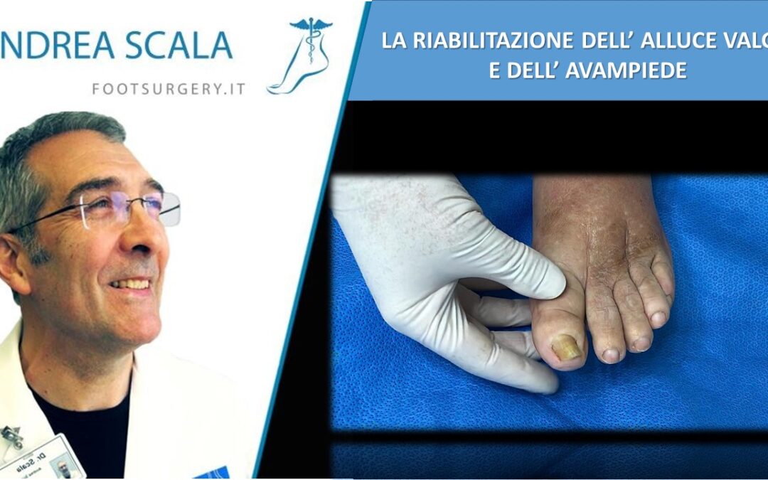 RIABILITAZIONE DELL’ALLUCE E DELL’AVAMPIEDE