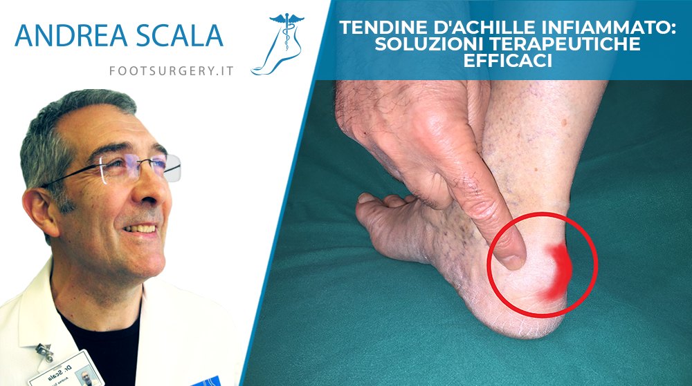 Tendine d'Achille infiammato soluzioni terapeutiche efficaci