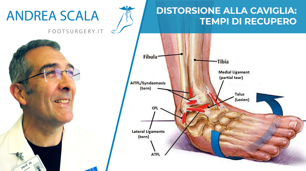 Distorsione alla caviglia: tempi di recupero