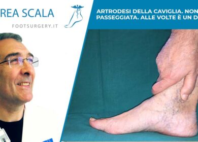 ARTRODESI DELLA CAVIGLIA. NON È UNA PASSEGGIATA. ALLE VOLTE È UN DELIRIO